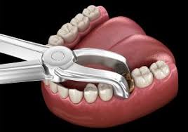 Emergency dental services in Kolkata